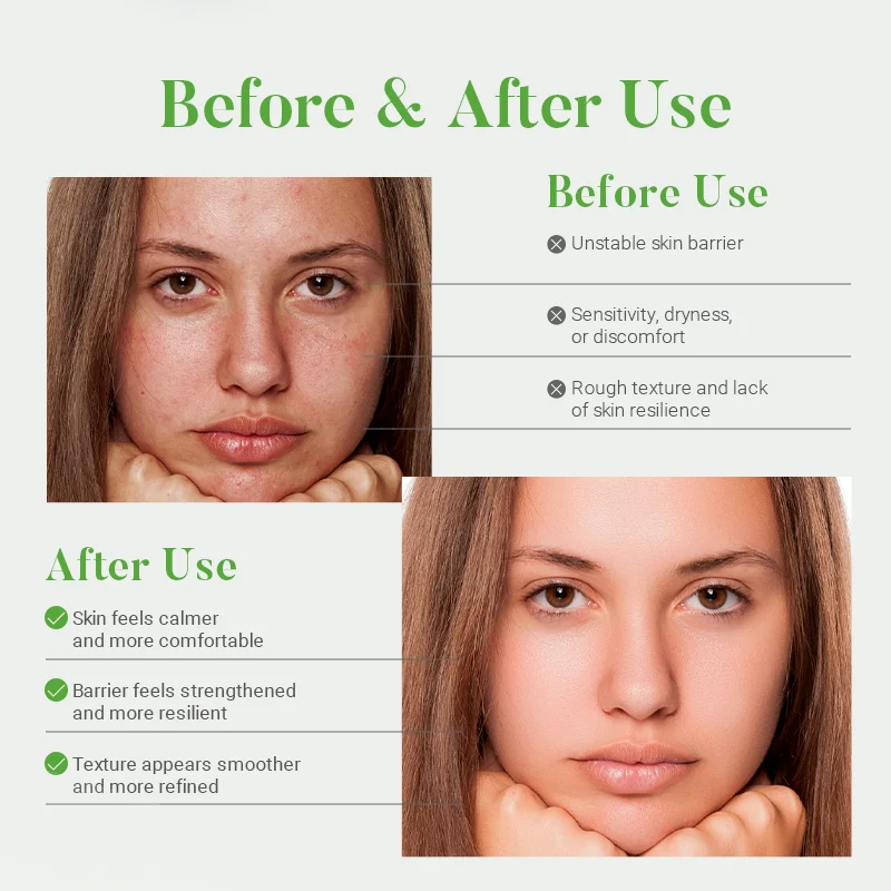 Comparison of skin condition before and after using a skincare product, highlighting reduced dryness and improved texture.